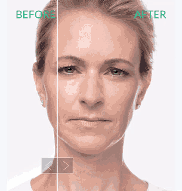 Before After GIF