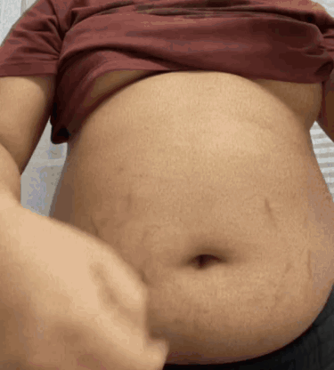 Belly Fat GIF