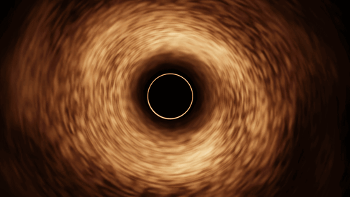 Blackhole Black Hole GIF