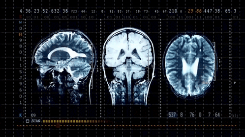 Brain Science GIF