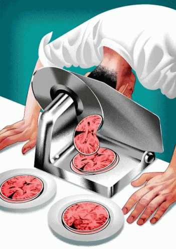 Brain Slice GIF