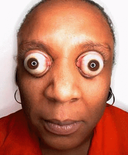 Bug Eyes Eyeroll GIF