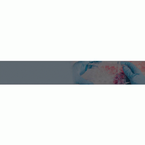 Diabetes Center Buffalo Ny Integrative Cancer Doctors Ny GIF. This 498 x 498 animated GIF is part of our cancer de mama collection. Created by ehcbuffalo…