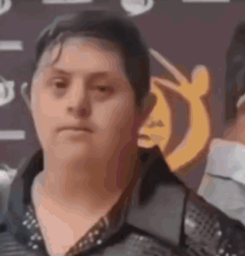 Down Syndrome GIF