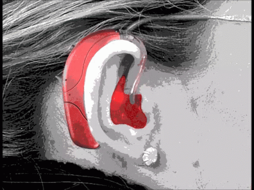 Ear Girl GIF. This 498 x 373 animated GIF is part of our hearing aid collection. Created by easterfarm1903. View the original animation, share it, or browse…