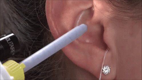 Ear Impression Earmold GIF