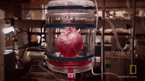 Heart Attack Heartbeat GIF