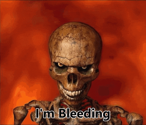 Im Bleeding From My Anus Skeleton GIF