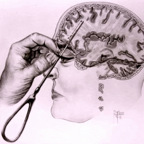 Lobotomy GIF