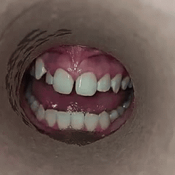 Mouth Weird GIF
