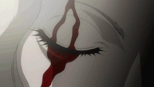 Opening Eye Blood In Eye GIF