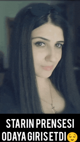 Prnss1 GIF