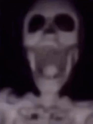 Skeleton Dead GIF