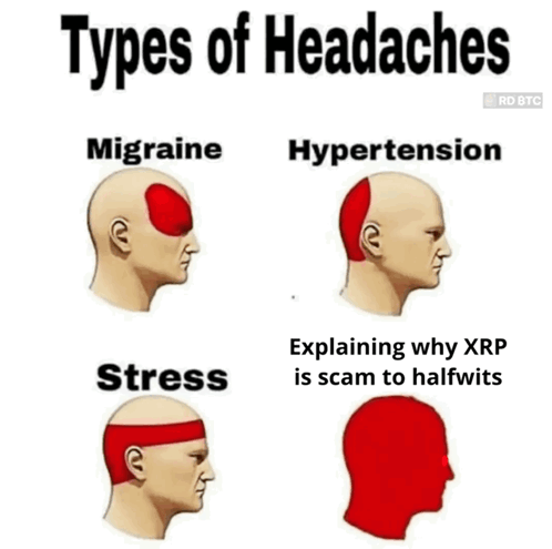 Xrp Types Of Headache GIF