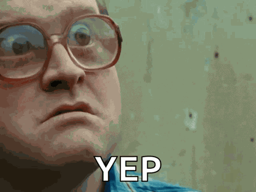 Big Eyes What GIF
