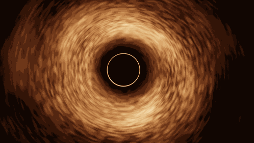 Blackhole Black Hole GIF