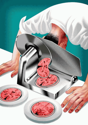 Brain Slice GIF