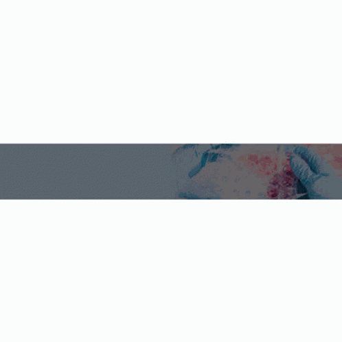 Diabetes Center Buffalo Ny Integrative Cancer Doctors Ny GIF