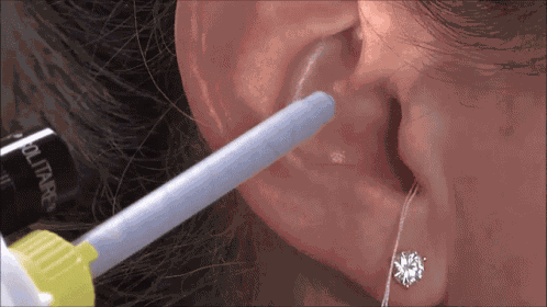 Ear Impression Earmold GIF