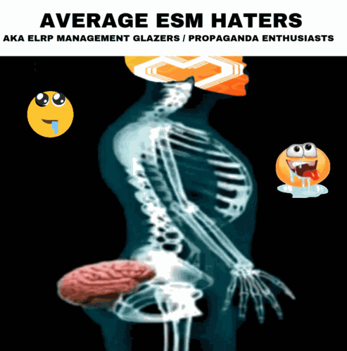 Esm Brain Dead GIF