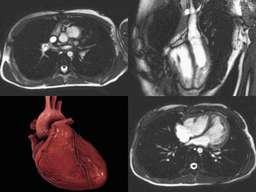 Heart Heart Real GIF