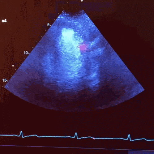 Heartbeat My GIF