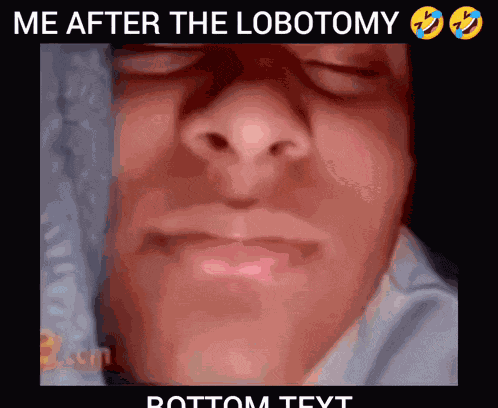 Lobotomy Funny GIF