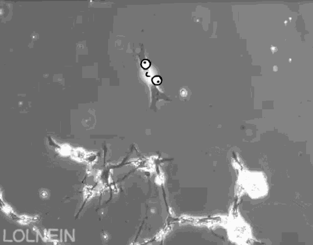 Lolnein Bacterias GIF