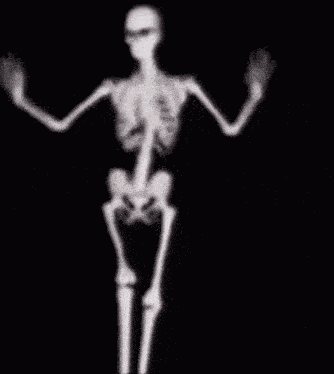 Skeleton Dance Skeleton Meme GIF
