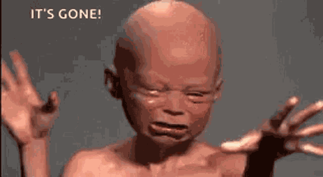 Ugly Baby GIF